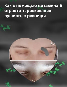 Как восстановить ресницы форум
